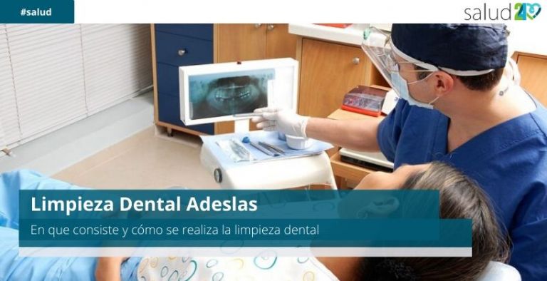 Limpieza dental Adeslas 23 Limpieza dental Adeslas