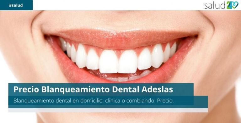 Precio Blanqueamiento Dental Adeslas 19 Precio Blanqueamiento Dental Adeslas